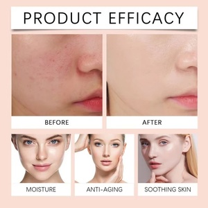 ครีมขมิ้นไวท์เทนนิ่งสำหรับผิวหน้า MOQ ต่ำ ผลิตภัณฑ์ฟอกผิวขาวสำหรับขายปลีก - Product Image 4