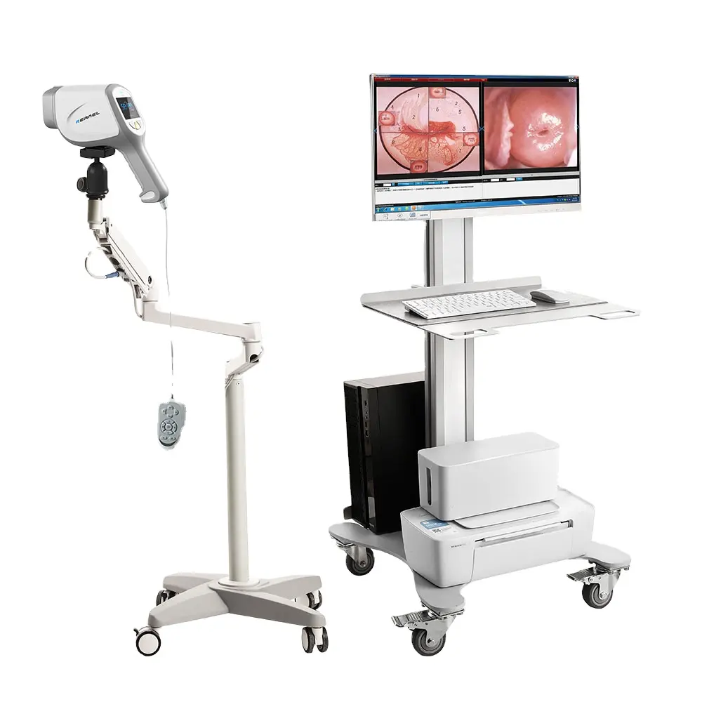 Draagbare Colposcoop Videocamera Colposcope KN-2200A Voor Gynaecologisch Onderzoek