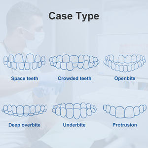 Sorriso trova 50ml di gomma per denti in gomma con mastice in Silicone materiale per impronta leggera del corpo - Product Image 6