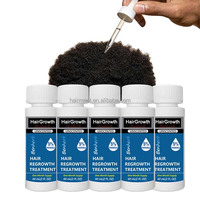 Kit d'huile capillaire bio 5% à base de plantes pour la repousse des cheveux, avec sérum nourrissant à l'huile de ricin pour le traitement de la perte de cheveux