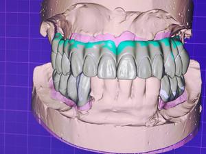 Impresora 3D Digital de Resina Rápida Yucera Cam Cad Dental de Nuevo Tipo para Clínica, Corona Temporal Transparente para Laboratorio y Clínica - Product Image 2