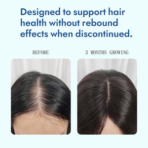 Suero para el <span class=keywords><strong>crecimiento</strong></span> del cabello para mujeres Roll on Cabeza calva Producto para el <span class=keywords><strong>crecimiento</strong></span> del cabello Aceite durante el <span class=keywords><strong>embarazo</strong></span> - Product Image 2