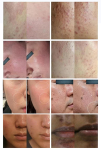 Appareil Anti-Âge 6-en-1 pour Salon : Nettoyage Complet, Hydratation, Raffermissement – Instrument de Beauté Facile à Utiliser et Économique pour Débutants - Product Image 4