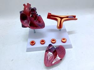 Modelo de injerto de derivación arterial para <span class=keywords><strong>el</strong></span> corazón, modelo de injerto de derivación de la coronaria para la enfermedad cardíaca, se atascan y se forman obstrucciones <span class=keywords><strong>en</strong></span> los vasos - Product Image 6