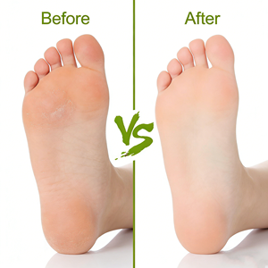 Pierre <span class=keywords><strong>ponce</strong></span> volcanique naturelle personnalisée avec votre logo pour éliminer les peaux mortes des pieds - Product Image 6