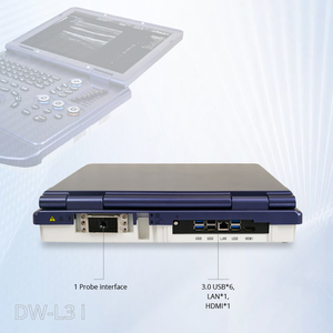 Sistema <span class=keywords><strong>de</strong></span> Ultrasonido Doppler Color Portátil Tipo Laptop Totalmente Digital DW-L3i con Imágenes 3D <span class=keywords><strong>de</strong></span> <span class=keywords><strong>Brazo</strong></span> Libre - Product Image 5