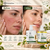 Crème réparatrice anti-inflammatoire à l'hamamélis fermenté, huiles apaisantes pour les rougeurs, soin réparateur nourrissant, ensemble de traitement pour massage spa