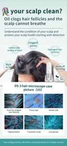 La PROMOCIÓN DE <span class=keywords><strong>Black</strong></span> <span class=keywords><strong>Friday</strong></span> mejora el servicio de cuidado del cabello con informe de cuero cabelludo alimentado por IA, trichoscopio inteligente profesional para Salón/spa - Product Image 3