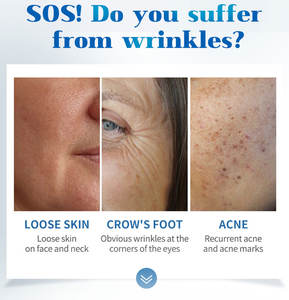 2025 più recente Laser frazionario 1470nm 1470 nm per la macchina di rimozione della cicatrice e della grinza 1470 nm laser di bellezza - Product Image 5