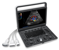 Sonoscape E2V diagnostic précis et efficace calcul automatique échographie vétérinaire doppler couleur haute résolution