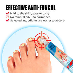 Solución Antihongos para Uñas, Crema Reparadora de Onicomicosis, <span class=keywords><strong>Tratamiento</strong></span> para Hongos en las Uñas de los Pies, Venta al Por Mayor - Product Image 4