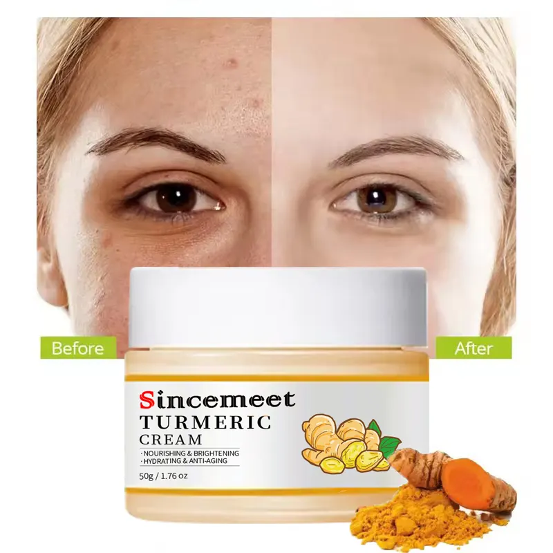 Private Label Organic Turmeric Cream Anti Aging Wrinkle Acne Nicotinamide Bleaching Dark Spot Remover Skin Whitening Face Cream