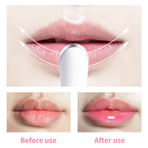 New products 2026 Lip Plumper Lip Moisturizer Match Electric Lip Plumper Device Machine Pen Engrosador De Labios Electronica - Product Image 4