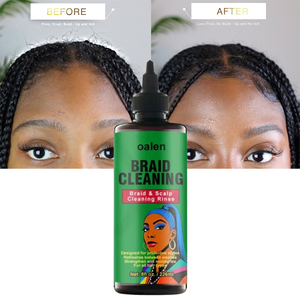 Après-shampoing purifiant détoxifiant au <span class=keywords><strong>vinaigre</strong></span> de <span class=keywords><strong>cidre</strong></span> de pomme pour le cuir chevelu, marque privée, pour le nettoyage des tresses, soulagement des démangeaisons, nettoyage en profondeur, protection et rafraîchissement. - Product Image 1