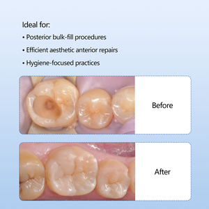 Résine <span class=keywords><strong>composite</strong></span> nano-céramique dentaire photopolymérisable en capsule, 0,3 g x 10, teinte A1/A2/A3/A3.5 - Product Image 5