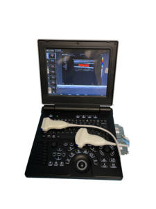 Equipamento médico ultra-som portátil Full Digital Color <span class=keywords><strong>Doppler</strong></span> <span class=keywords><strong>Ultrasonic</strong></span> Diagnostic System - Product Image 4