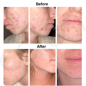 Crema Facial Luxfume de Marca Privada con Vitamina C en Perlas Doradas y Niacinamida, Textura en <span class=keywords><strong>Gel</strong></span> Iluminadora e Hidratante, Mejora la <span class=keywords><strong>Piel</strong></span> Áspera - Product Image 4