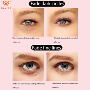 Dispositivo PAKISS EMS per la Cura degli Occhi con Microcorrente, Luce Rossa 630nm e Riscaldamento Terapeutico - Massaggiatore Oculare Ricaricabile per Uso Domestico - Product Image 5