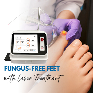 Máquina Láser de Diodo de 980nm para Tratamiento de Hongos en las Uñas de los Pies (Onicomicosis) y Eliminación <span class=keywords><strong>Capilar</strong></span> Vascular - Product Image 5