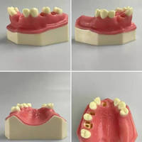 Modelo Maxilar de Práctica de Implantes Dentales KyrenMed con Seno