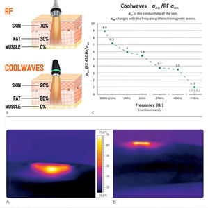 Dispositivo Portátil Multifuncional Onda Coolwave para el Hogar, Tratamiento No Invasivo para la Celulitis, Disolución de Grasa Corporal - Product Image 5