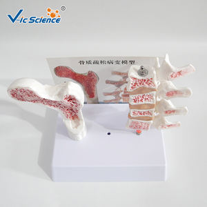 Modèle d'os pathologique en PVC pour l'ostéoporose avec carte dorsale - Modèle de <span class=keywords><strong>squelette</strong></span> <span class=keywords><strong>humain</strong></span> - Product Image 4