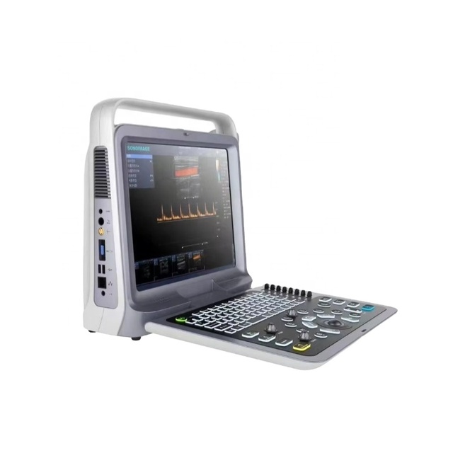 P60 Portable Veterinary Ultrasound Scanner Color Doppler 5 Multi-Frequency Probes High-Resolution LCD 500GB Storage