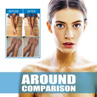 Crème Traitement du Vitiligo pour le Corps – Élimine les Taches Blanches, la Teigne, la Leucoplakie Cutanée, la Dermatite – Certifié Médical SGS Classe I