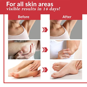 Aangepaste Private Label Antioxidant Huid Whitening Capsules Voor Volwassenen Collageen Vitamine C L-Glutathion Sterke Schoonheidsproducten Voor - Product Image 6