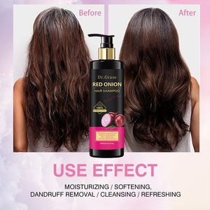 <span class=keywords><strong>Shampoo</strong></span> Professionale Anticaduta e Antiforfora con Cipolla Rossa, Biologico e Senza Solfati, Marchio Privato - Product Image 6