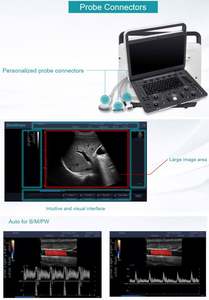 High-End Diagnostisch Systeem Sonoscape Doppler Ultrasone Machine Sonoscape E1 - Product Image 4