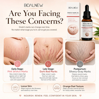 Minyak Tubuh OEM Fade Scar Regeneration untuk Ibu Hamil, Perbaikan Perut, Pelembap Gliserin, Minyak Pijat, Minyak Esensial untuk Stretch Mark