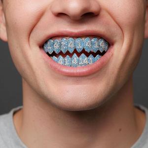 Grillz de luxe en argent sterling 925 plaqué rhodium avec moissanite taille brillant, style diamant, bijoux dentaires unisexe, tendance streetwear - Product Image 1
