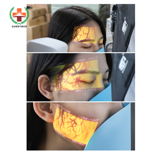 SY-G090S Pencari Vena Inframerah Presisi Waktu Nyata Multiwarna Opsional untuk Penggunaan di Rumah - Product Image 4