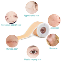 Personnalisation de la récupération des cicatrices chirurgicales Healing Keloid C-Section Tummy Tuck Feuilles de cicatrices en silicone