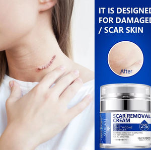 <span class=keywords><strong>Pour</strong></span> Herbicos Best-Selling Herbal Scar Removal Cream <span class=keywords><strong>pour</strong></span> réparer le corps Pock Mark Burn Surgical Scar Stretch Markets Smooth - Product Image 6