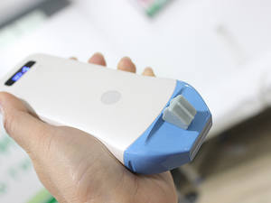 Sonda lineal Gelt 14MHz ultrasonido inalámbrico para vena - Product Image 5