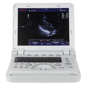 CONTEC CMS1700A couleur grossesse portable doppler machines ultrasons - Product Image 2