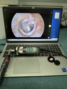 TUYOU TU-FHD USB2.0 Kamera Endoskop Portabel USB - Otoskop Digital untuk Dokter THT, Kompatibel dengan Laptop Windows - Product Image 6