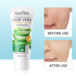 Sadoer เจลล้างหน้าว่านหางจระเข้ยี่ห้อส่วนตัวล้างหน้าอย่างอ่อนโยนชุ่มชื้นสำหรับผู้ใหญ่ผิวนุ่มและใส
