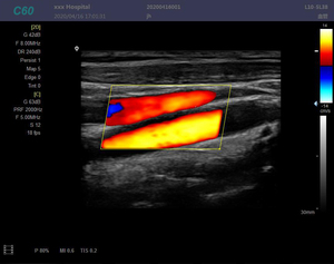 Sistema de Ultrasonido Profesional HD 3D 4D de 15 Pulgadas con Función Doppler PW CW para Aplicaciones de Cardiología - Product Image 6