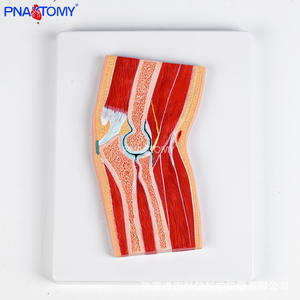 Modelo Anatómico Seccional de Rodilla Humana con <span class=keywords><strong>Menisco</strong></span>, de PVC, para Enseñanza, Entrenamiento <span class=keywords><strong>y</strong></span> Comunicación con Pacientes - Product Image 6