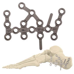 Plaque de blocage en titane CANWELL pour le calcaneeuse, implant orthopédique pour traumatismes du pied <span class=keywords><strong>et</strong></span> de la <span class=keywords><strong>cheville</strong></span>, chirurgie des fractures, CE ISO - Product Image 1