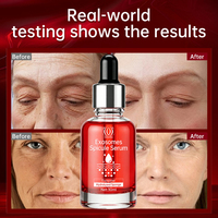 Sérum en gros aux exosomes de Calantha et spicules 30ml – Régénération cutanée avancée, Essence anti-âge pour le visage