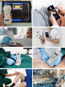 Premium Portable D3 Pro <span class=keywords><strong>Ultrasound</strong></span> Double Head, <span class=keywords><strong>3</strong></span>-in-<span class=keywords><strong>1</strong></span> dengan Doppler warna, cembung <span class=keywords><strong>3</strong></span>.5/5 <span class=keywords><strong>MHz</strong></span> & 7.5/10 <span class=keywords><strong>MHz</strong></span> probe Linear - Product Image 5