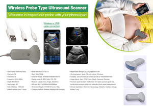 Ecógrafo Inalámbrico JM-3C Doppler Color, Sonda Convexa de 3.2MHz/4MHz Reutilizable, Escáner de Ultrasonido USB, Imágenes de Abdomen PW PDI - Product Image 6
