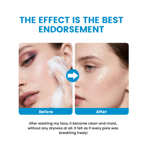 <span class=keywords><strong>Limpiador</strong></span> <span class=keywords><strong>Facial</strong></span> con Aminoácidos, Limpia Suavemente la Suciedad y la Grasa, Protege la Barrera Cutánea, Apto para <span class=keywords><strong>Piel</strong></span> <span class=keywords><strong>Sensible</strong></span> y Seca, Hidratante, Lavado <span class=keywords><strong>Facial</strong></span> Diario - Product Image 6