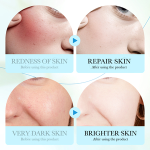 Masque facial en coton biologique coréen ZOZU en gros, rafraîchissant et hydratant, aux ingrédients végétaux et non chimiques, pour le soin de la peau du visage - Product Image 5