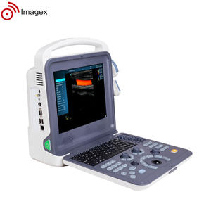 凸面と線形プローブを備えたポータブルカラードプラー超音波 - Product Image 3