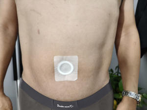 Les patchs médicinaux pour la réduction de la graisse abdominale peuvent améliorer la circulation sanguine, favorisant ainsi le métabolisme des graisses et la détoxification. - Product Image 4